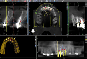 Visual of dental x-rays